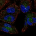 Immunofluorescent staining of human cell line RH-30 shows localization to cytosol.