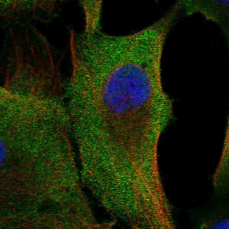 Anti-C20orf141 Antibody