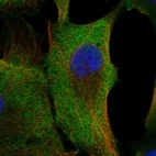 Anti-C20orf141 Antibody