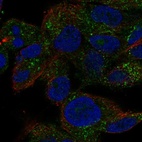 Anti-TRIM51 Antibody