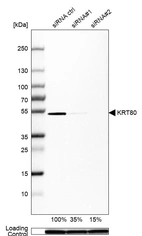 Anti-KRT80 Antibody