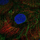 Immunofluorescent staining of human cell line A-431 shows localization to intermediate filaments.