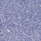 Immunohistochemical staining of human tonsil shows low expression as expected.