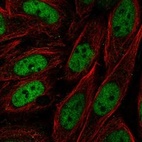Anti-ZNF843 Antibody