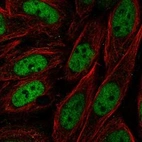 Anti-ZNF843 Antibody