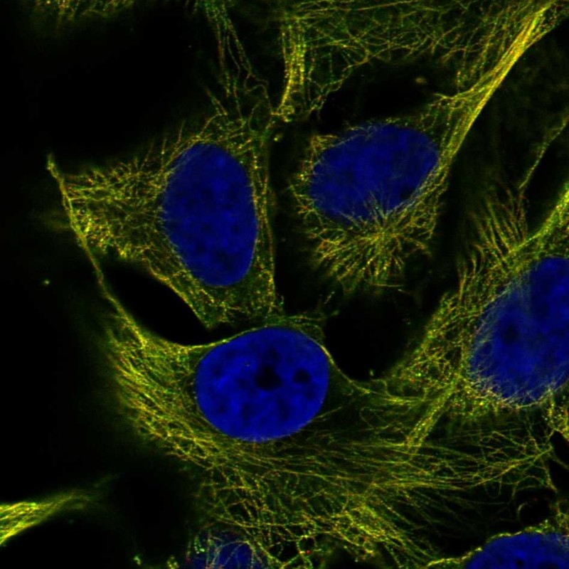 Anti-ZNF654 Antibody