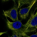 Anti-ZNF654 Antibody
