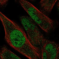 Anti-ZNF329 Antibody
