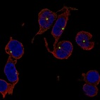 Anti-TRIM34 Antibody