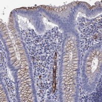 Anti-MADCAM1 Antibody