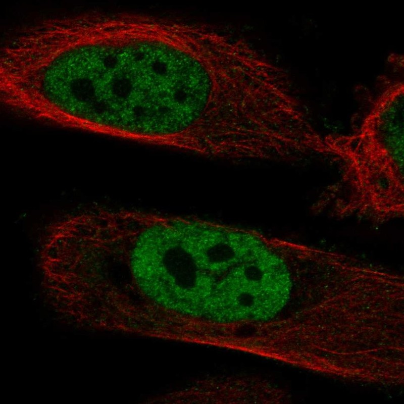Anti-POLM Antibody
