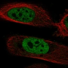 Anti-POLM Antibody