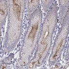 Immunohistochemical staining of human stomach shows high expression.