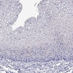 Immunohistochemical staining of human esophagus shows low expression as expected.