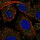 Anti-MAP4K5 Antibody