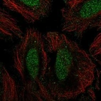 Anti-SIK1 Antibody