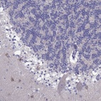 Anti-PCDHA6 Antibody