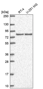 Anti-DLG3 Antibody