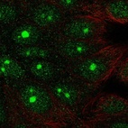 Anti-DLG3 Antibody