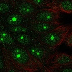 Immunofluorescent staining of human cell line MCF7 shows localization to nucleus & nucleoli.