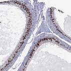 Anti-ZNHIT3 Antibody