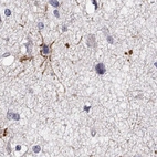 Immunohistochemical staining of human cerebral cortex shows high expression.
