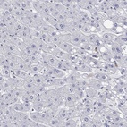 Immunohistochemical staining of human liver shows low expression as expected.