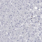 Immunohistochemical staining of human liver shows low expression as expected.