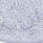 Anti-ZNF446 Antibody