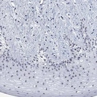 Anti-ZNF446 Antibody