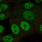 Anti-NHLRC1 Antibody