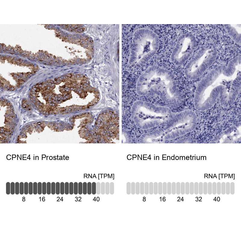 Anti-CPNE4 Antibody
