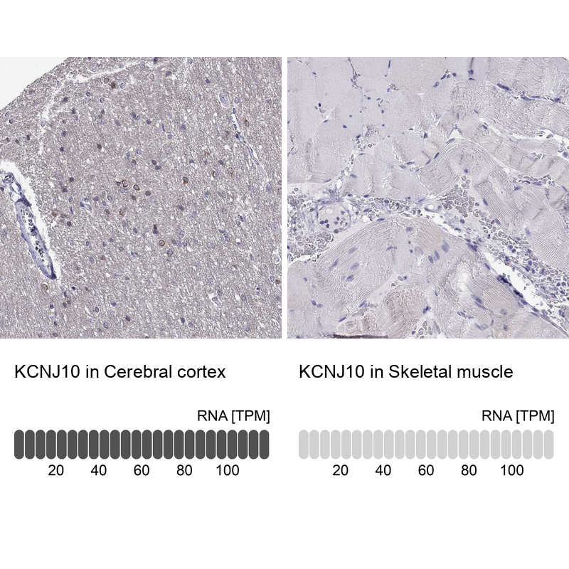 Anti-KCNJ10 Antibody