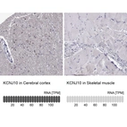 Anti-KCNJ10 Antibody