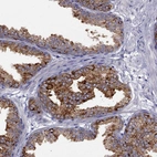 Immunohistochemical staining of human prostate shows strong cytoplasmic granular positivity in glandular cells.