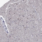 Immunohistochemical staining of human cerebral cortex shows moderate cytoplasmic positivity in glial cells.
