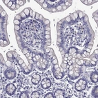 Immunohistochemical staining of human small intestine shows no positivity in glandular cells as expected.