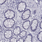 Immunohistochemical staining of human colon shows no positivity in glandular cells as expected.