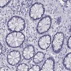 Immunohistochemical staining of human colon shows no positivity in glandular cells as expected.