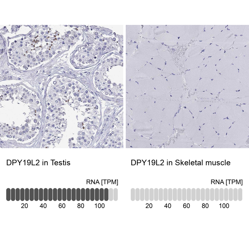 Anti-DPY19L2 Antibody
