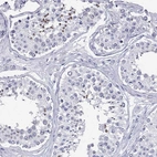 Immunohistochemical staining of human testis shows high expression.