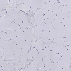 Immunohistochemical staining of human skeletal muscle shows low expression as expected.