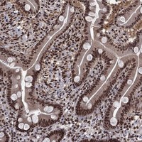 Anti-SAP30L Antibody