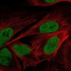 Immunofluorescent staining of human cell line U-2 OS shows localization to nucleoplasm.