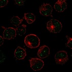 Anti-MSH5 Antibody