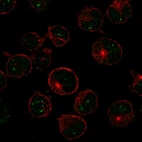 Anti-MSH5 Antibody