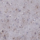Anti-APPBP2 Antibody