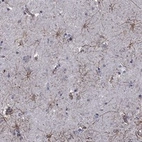 Anti-APPBP2 Antibody