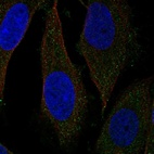 Anti-NUDT19 Antibody