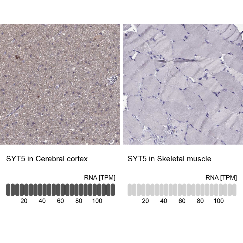 Anti-SYT5 Antibody
